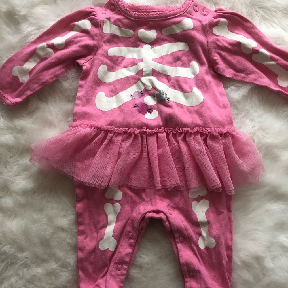 Baby outfit